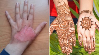 Henna Tattoos Cause Aussie Woman to Almost Lose Her Hands; Here's What You  Should Know | 🍏 LatestLY