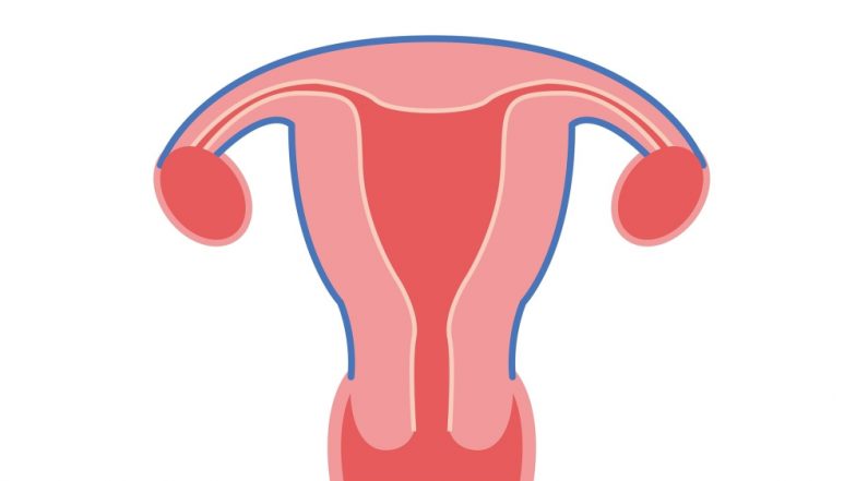 Endometriosis Cause Discovered By Scientists Who Are Hopeful of a Cure Soon