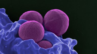 Indoor Dust Bacteria Have Transferrable Antibiotic Resistance Genes: Study
