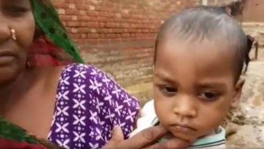 Uttar Pradesh: 2-Year-Old Girl’s Head Gets Stuck Inside a Vessel in Hardoi
