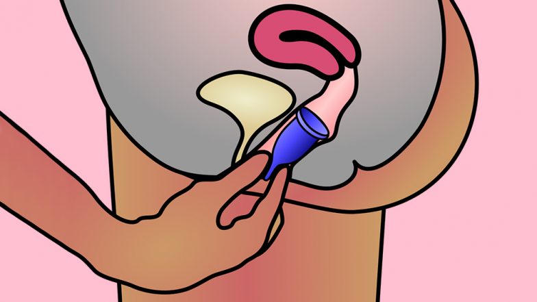 Menstrual Cup Use: The Pros, Cons and Safety Concerns of This Menstrual Hygiene Device