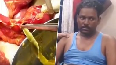 GROSS! 6-Foot-Long Tapeworm Removed From Haryana Man’s Intestines, Watch Stomach-Churning Viral Video