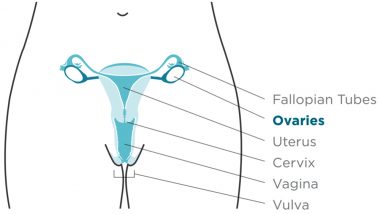 World Ovarian Cancer Day 2020 Date History and Significance: Raising Funds and Making Research a Priority to Beat This Deadly CancerPriority to Beat This Deadly Cancer