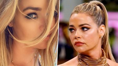 Denise Richards' Enlarged Thyroid Spotted By Fans During RHOBH Reunion Episode, Reality Star Goes on Gluten-Free Diet