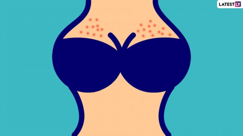 The Real Reason Your Breasts Are Itchy