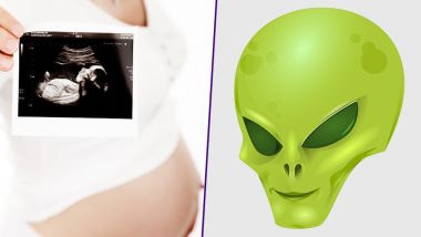 Mother of An Alien? Baby Scan of Pregnant Teen Mum Shows Extraterrestrial Face!