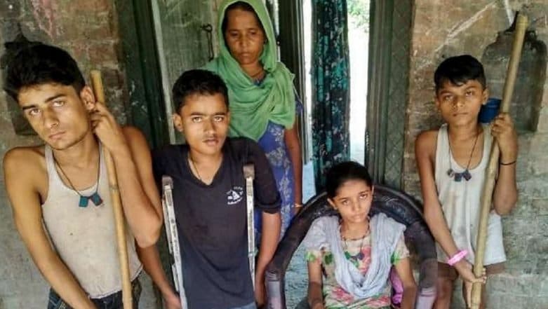 Uttar Pradesh: Four Members of a Family Affected With Polio Even After Drops Given on Time Uttar Pradesh: Four Members of a Family Affected With Polio Even After Drops Given on Time