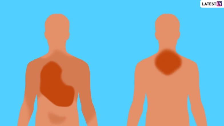 Difference Between Heart Pain And Chest Muscle Pain