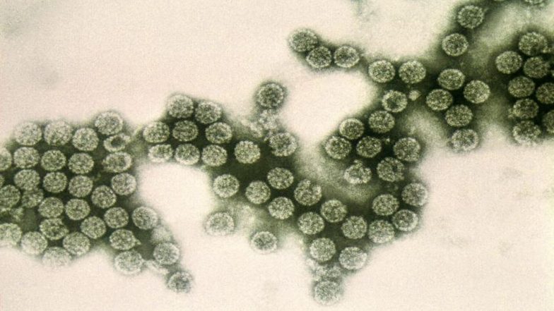 Israeli Flight Attendant Dies of Measles, Anti-Vaxxers Back in the Spotlight
