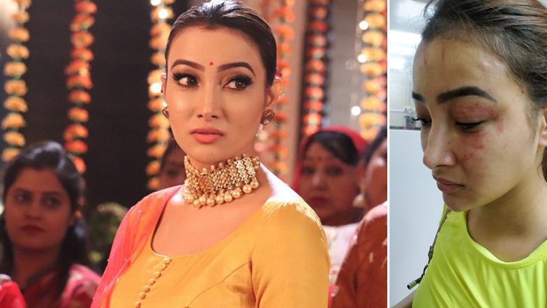 Naamkaran Fame Nalini Negi Files FIR Against Roommate, Preeti Rana for Physically Assaulting Her