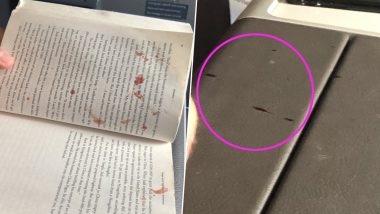 American Airlines Passenger's Huge Blister Pops in Miami-Bound Flight, Blood Splatters on Fellow Passengers and Flight Wall! (View Pics)