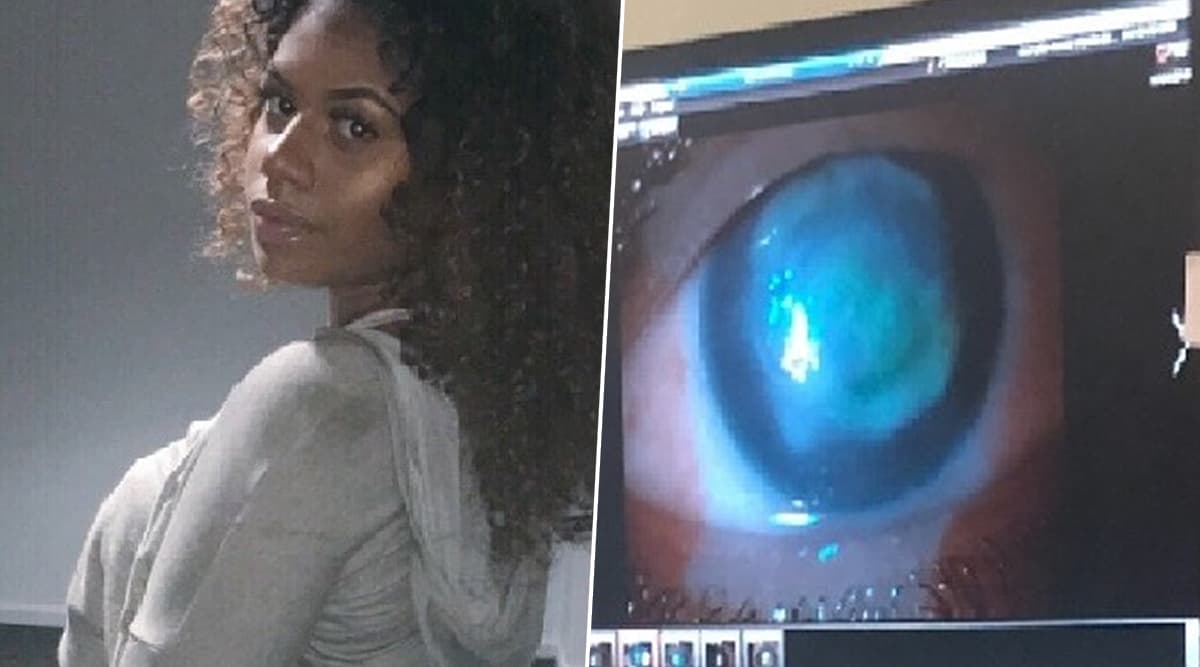 British Student Gets Hit by a Wave While Swimming With Contact Lenses, Loses Eyesight Completely British Student Gets Hit by a Wave While Swimming With Contact Lenses, Loses Eyesight Completely