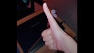 US Student Jacob Pina&rsquo;s Unusual Five-Inch Thumb Stuns the Internet, Check Out Viral TikTok Videos of the Rest of His Hand