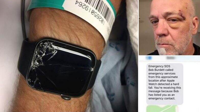 Apple Watch Detects Fall, Autodials 911, Helps EMS & Family to Locate US Mountain Biker Who Lay Unconscious After Terrible Accident (View Viral Pics) Apple Watch Detects Fall, Autodials 911, Helps EMS & Family to Locate US Mountain Biker Who Lay Unconscious After Terrible Accident (View Viral Pics)