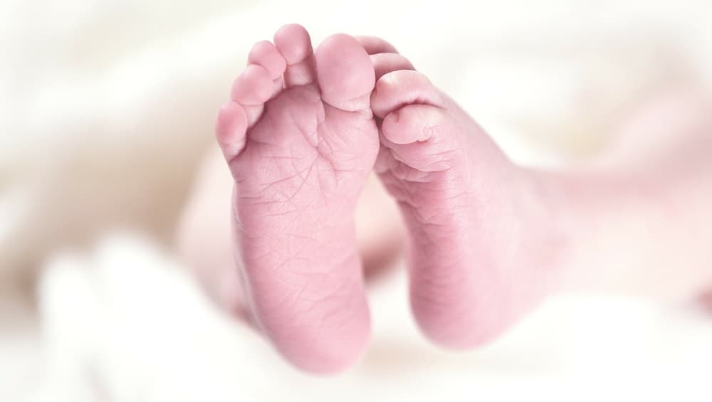 Portugal: Doctor Suspended in Lisbon After Baby Born Without a Face Portugal: Doctor Suspended in Lisbon After Baby Born Without a Face