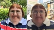 Disabled Blogger Melissa Blake Posts Defiant Pictures After Trolls Told Her She Was &lsquo;Too Ugly for Selfies&rsquo; (Check Viral Thread)