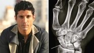 Farhan Akhtar Suffers Hairline Fracture While Shooting for Toofan, Actor Shares Proof on Instagram (View Pic)