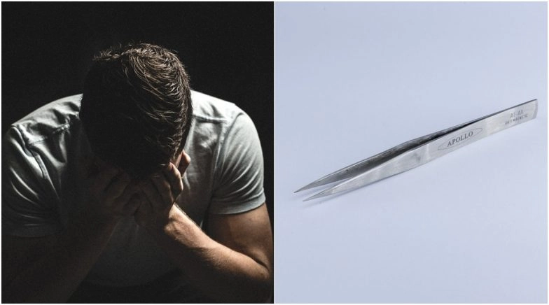 Man Inserts Tweezers in His Urethra, Doctors Successfully Remove Them After 4 Years