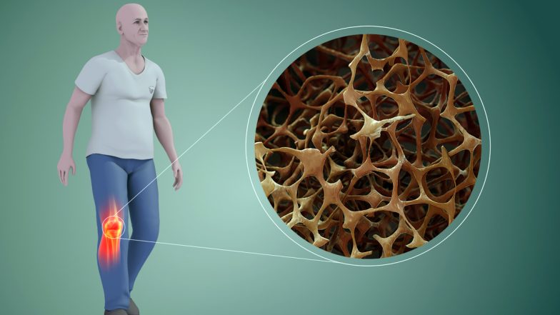 World Osteoporosis Day 2019: History, Theme and Significance of The Dedicated To The Bone Disease