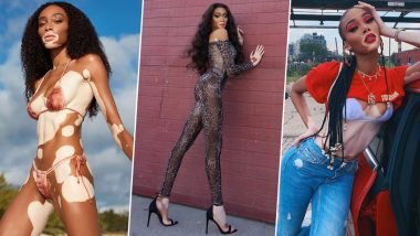 Thirstday Special: Just a Few Sexy Pictures of Winnie Harlow to Make You Go ‘ HOT DAMN!’