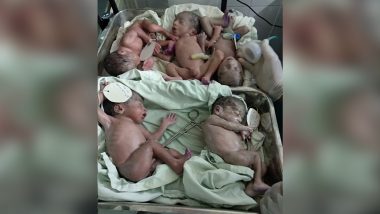 Woman Gives Birth to Premature Quintuplets in Jaipur; Here's All About Rare Case of Multiple Births in Humans