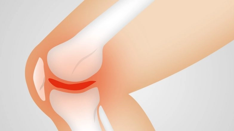 World Arthritis Day 2019: Did You Know There Are 120 Types of Arthritis? Interesting Facts About The Inflammatory Condition