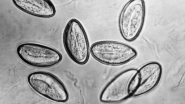 Pinworms in Woman&rsquo;s Butt Laid Eggs, Caused Itchiness and Bleeding for 2 Months! Everything About Enterobius Vermicularis