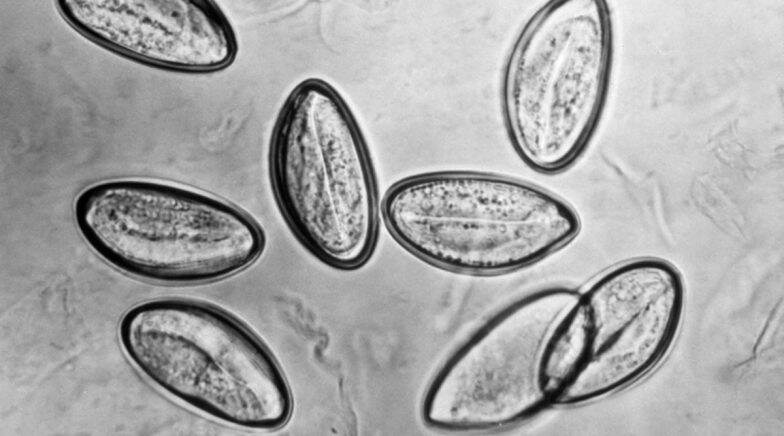 Pinworms in Woman’s Butt Laid Eggs, Caused Itchiness and Bleeding