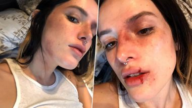 Bella Thorne Slammed for Her Halloween Post; Did the ‘Midnight Sun’ Star Glamourise Physical Abuse?