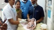 Boy Born With 2 Heads and 3 Hands in Madhya Pradesh; What is Structural Birth Defect? Know Its Causes