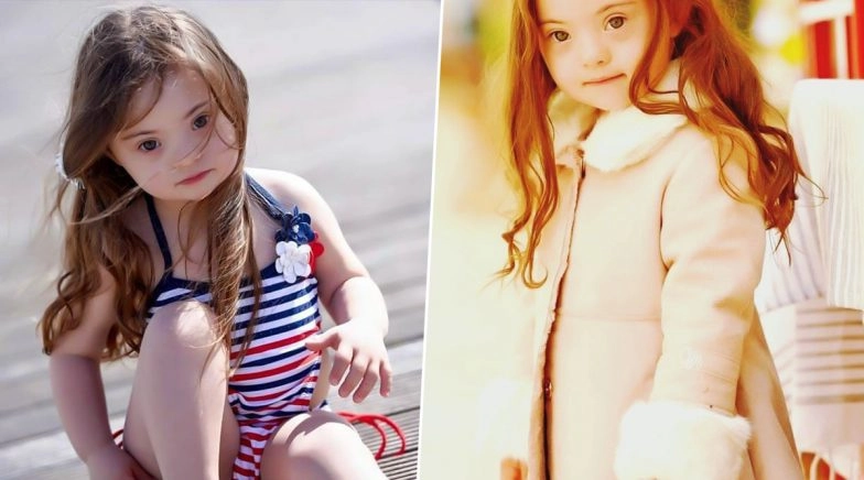 Francesca Rausi, 4-Year-Old Down Syndrome Model Is Winning Hearts 
