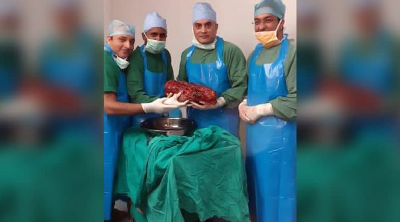 World’s 3rd Heaviest Kidney Removed by Delhi Doctors