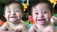 This Adorable Video of Baby Girl With Down Syndrome Smiling Will Tug at Your Heartstrings! (Watch Video)