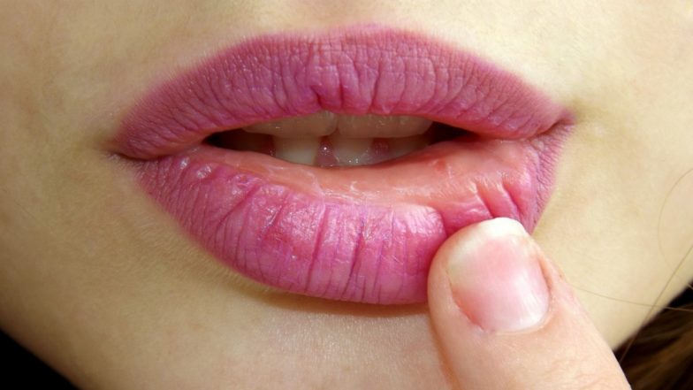 From Eyebrow Dandruff to Chapped Nose, Here's How to Solve the 6 Most Common Winter Skin Problems