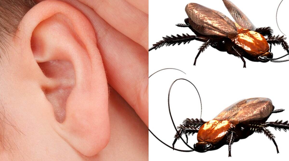 Chinese Man Wakes Up With Terrible Pain in Ears, Finds Out Family of Cockroaches Living Inside His Ear Canal Chinese Man Wakes Up With Terrible Pain in Ears, Finds Out Family of Cockroaches Living Inside His Ear Canal