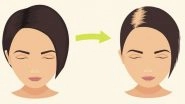 Hair Loss Causes: Is Your Hair Fall Normal? How Much Shedding Is OK and When Should It Be a Concern