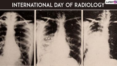 International Day of Radiology 2019: History, Theme and Significance of the Day Dedicated to Medical Imaging