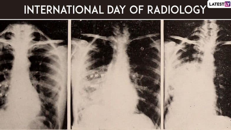 International Day of Radiology 2019: History, Theme and Significance of the Day Dedicated to Medical Imaging International Day of Radiology 2019: History, Theme and Significance of the Day Dedicated to Medical Imaging