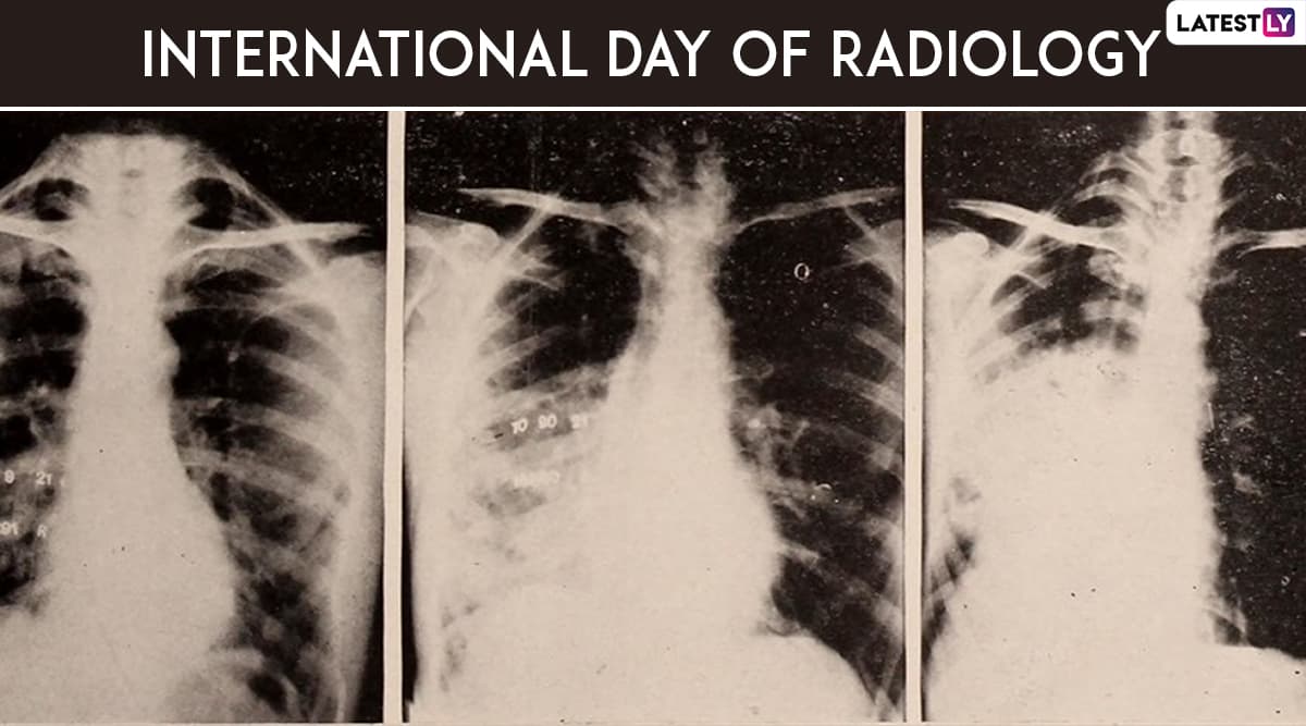 International Day of Radiology 2019: History, Theme and Significance of the Day Dedicated to Medical Imaging International Day of Radiology 2019: History, Theme and Significance of the Day Dedicated to Medical Imaging
