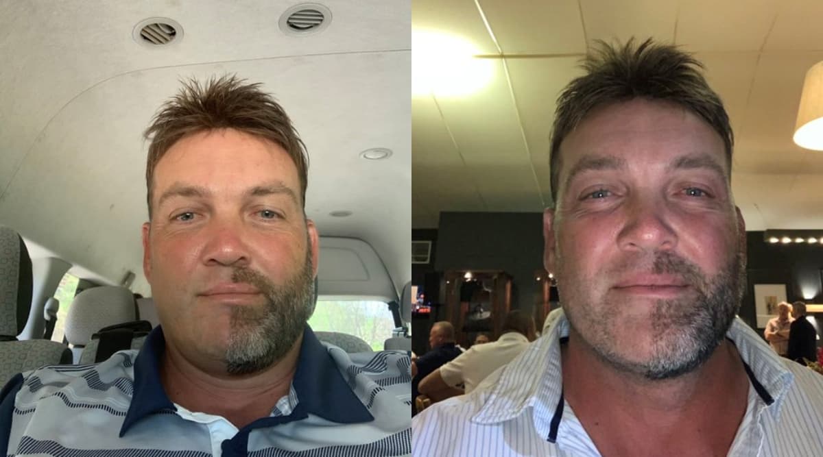 Why Jacques Kallis Shaved Exactly Half of His Beard & Moustache? Why Jacques Kallis Shaved Exactly Half of His Beard & Moustache?