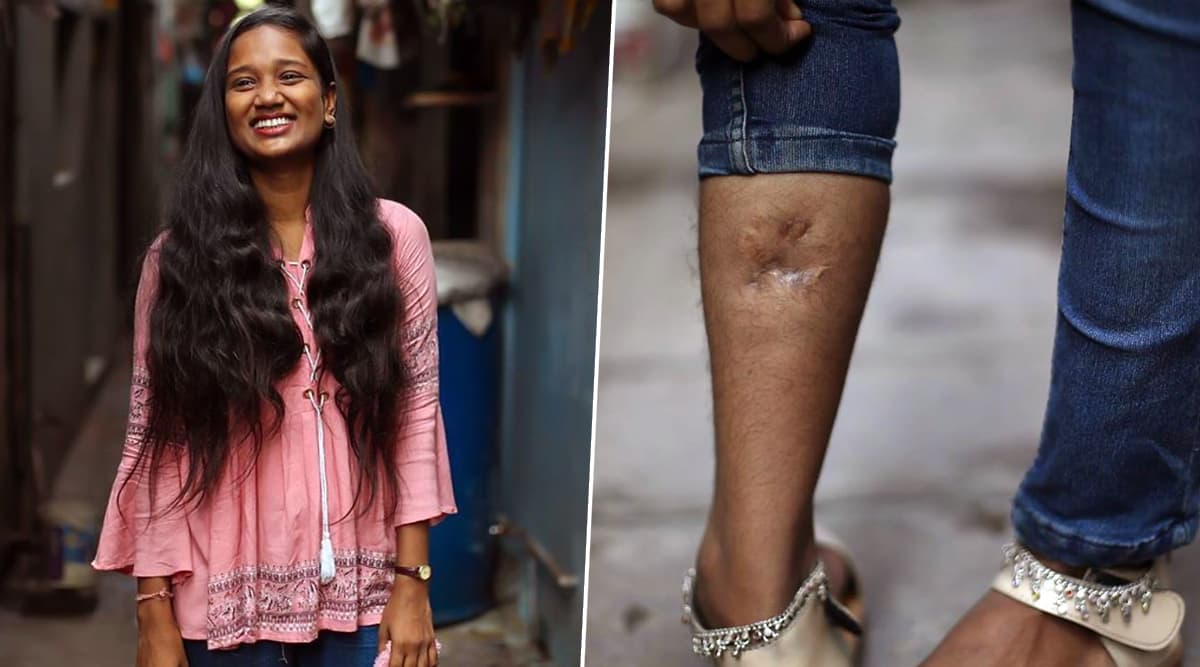 26/11 Survivor Devika Rotawan Who Was Shot by Ajmal Kasab on Right Leg Recollects Horrific Mumbai Attack, Says She Wants to be IPS officer 26/11 Survivor Devika Rotawan Who Was Shot by Ajmal Kasab on Right Leg Recollects Horrific Mumbai Attack, Says She Wants to be IPS officer