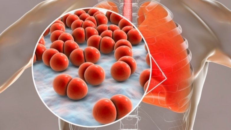 Pneumonia Outbreak in China Sparks Fear of Deadly SARS Virus