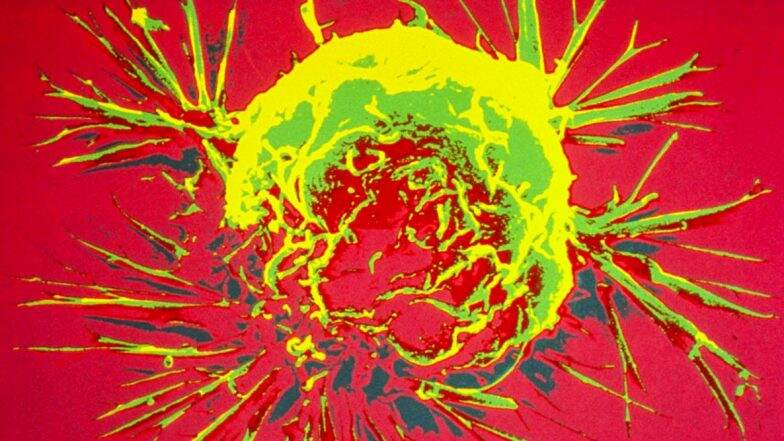 National Cancer Awareness Day 2019: How Does Cancer Spread? From Genesis to Metastasis of the Disease National Cancer Awareness Day 2019: How Does Cancer Spread? From Genesis to Metastasis of the Disease