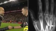 Michael Oliver Gets a Broken Hand After Pep Guardiola&rsquo;s Sarcastic Handshake After Liverpool vs Manchester City, EPL 2019?