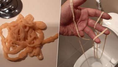 Man Pulls Out 32ft Tapeworm from His Butt While on the Toilet; Watch Stomach-Churning Video (WARNING: GRAPHIC CONTENT)