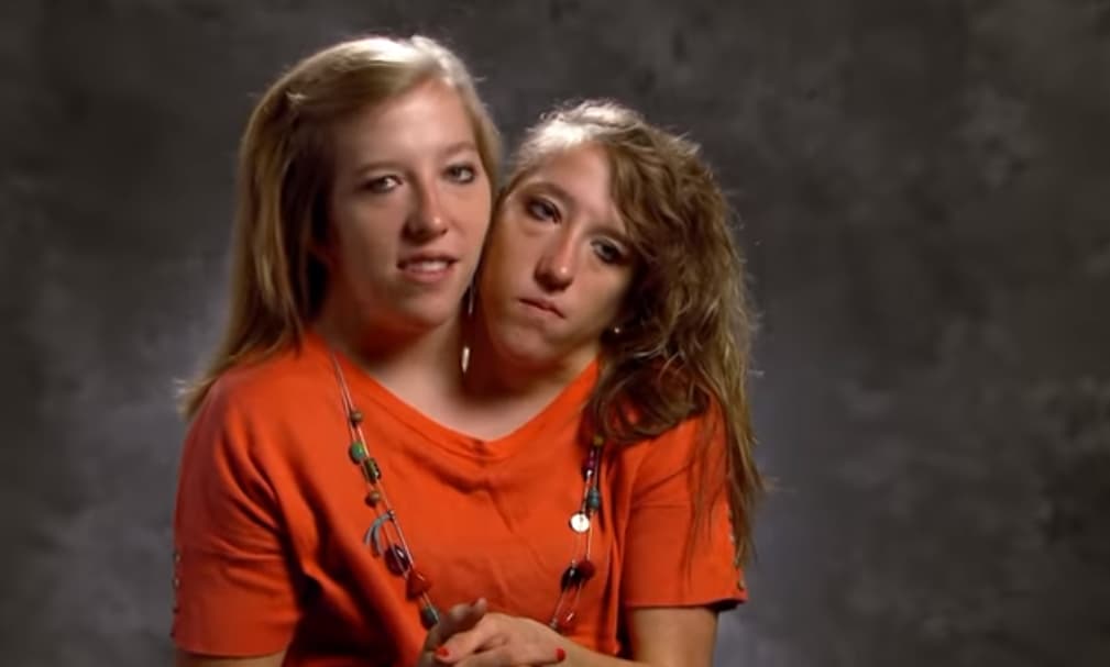 Conjoined twins Abby and Brittany Hensel explain how they drive a car