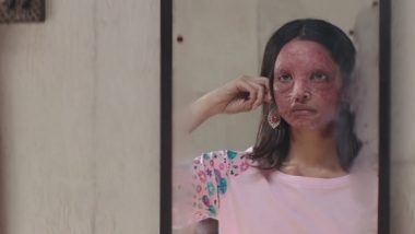 Deepika Padukone's Chhapaak Trailer is Timely For This is the Inspiration Women Need Right Now!