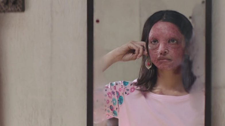 Deepika Padukone's Chhapaak Trailer is Timely For This is the Inspiration Women Need Right Now!