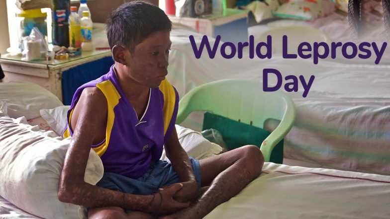 World Leprosy Day 2020 Date: History and Significance of the Day Dedicated to Hansen’s Disease