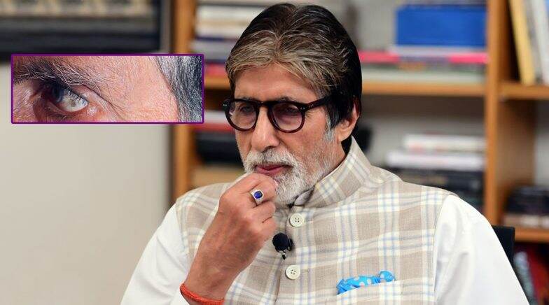 Amitabh Bachchan Visits Doctor Due to a Black Spot in His Left Eye, Pens an Emotional Post
